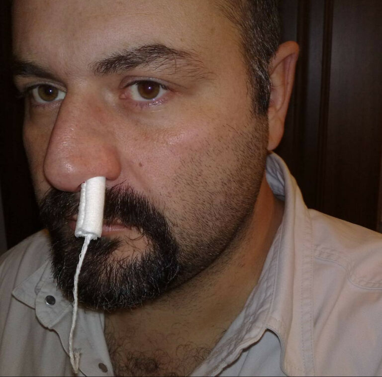 Scopri di più sull'articolo Ragazzi, io di tampone sono riuscito a trovare solo questo. Dite che va bene lo…