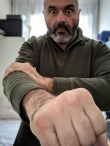 Scopri di più sull'articolo EPICONDILITE o “gomito del tennista” è una patologia che insorge spontanea alla…
