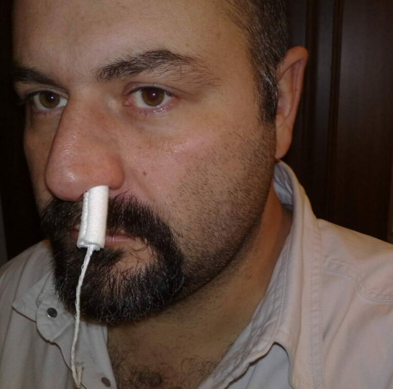 Scopri di più sull'articolo Mi hanno consigliato di fare il tampone per il Coronavirus ma non sono proprio…