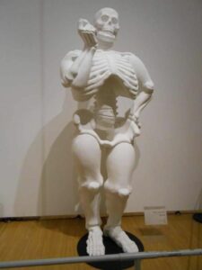 Scopri di più sull'articolo Qualcuno fra di voi è esperto di osteosintesi? Perché in questi giorni sono…